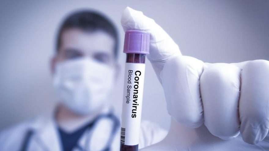 Rusya , Corona aşısını eczanelerde satmaya başladı