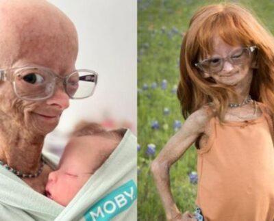 Adalia Rose Williams