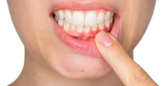 Tedavi edilmeyen diş iltihabı ölümcül olabilir