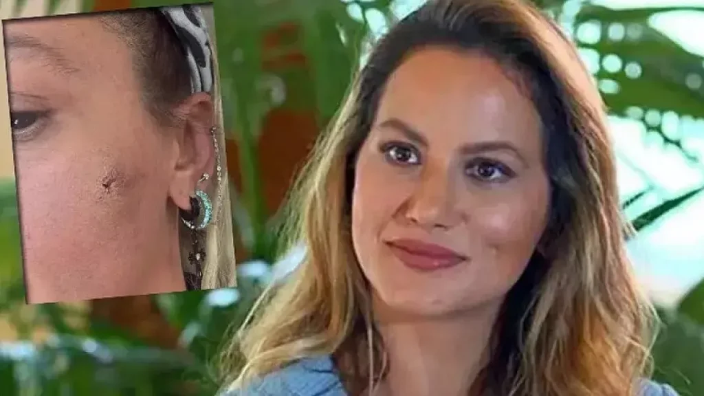 yildiz asyali darp mi edildi 1765263718 xWB3Cq