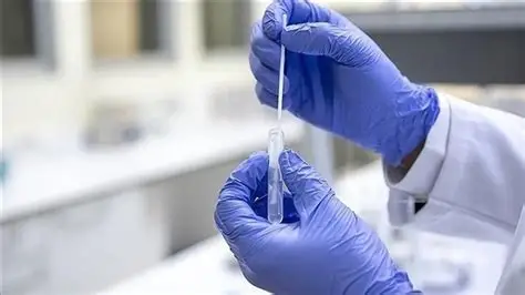 Rusya’da veba paniği: 28 yaşındaki laboratuvar teknisyeni öldü, 189 kişi karantinada